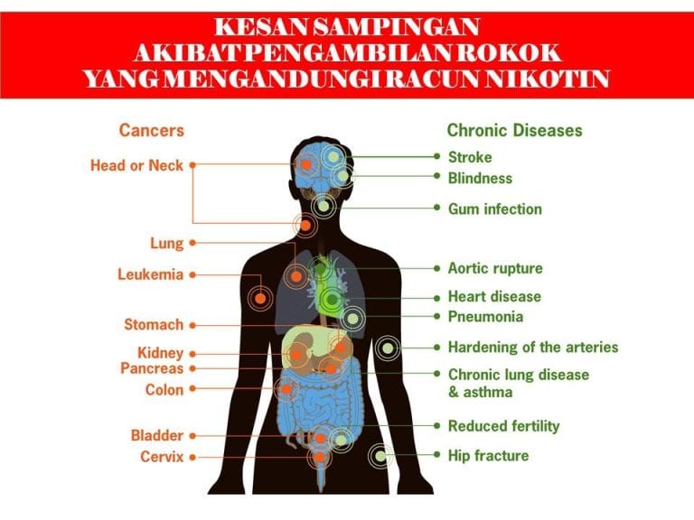 5 Bahaya Vape Rokok Elektronik E Cigarette KKM