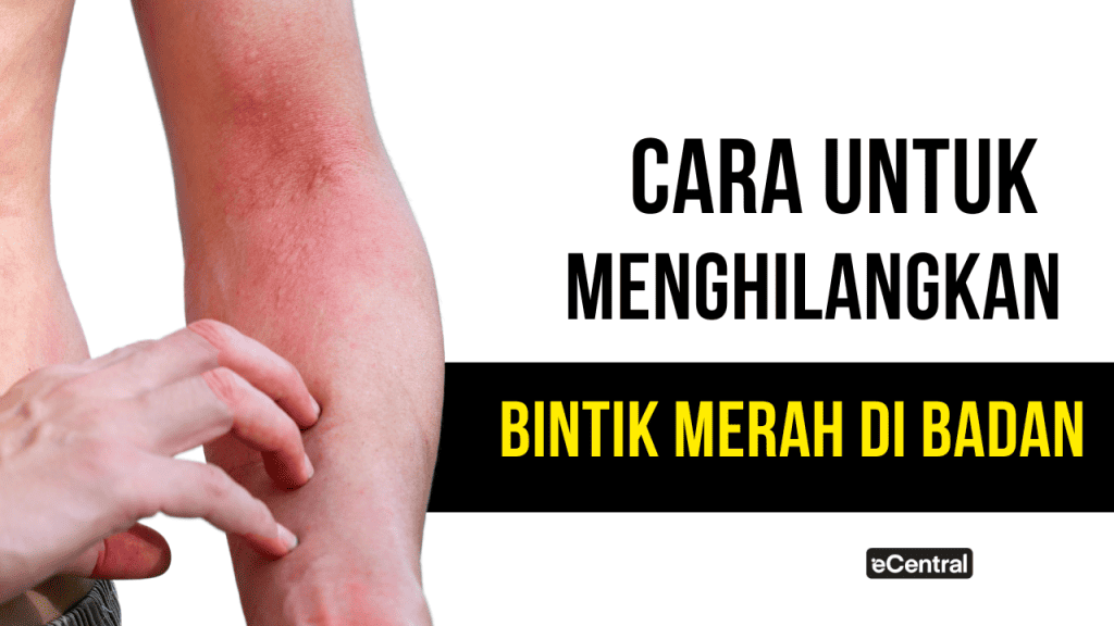 Bintik Merah Di Badan Punca Cara Untuk Menghilangkan