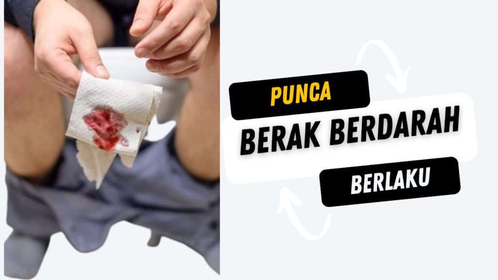 Berak Berdarah Tanda Kanser? Fahami Punca, Gejala, dan Rawatannya