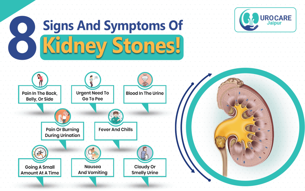 the-haddock-s-kidney-stones