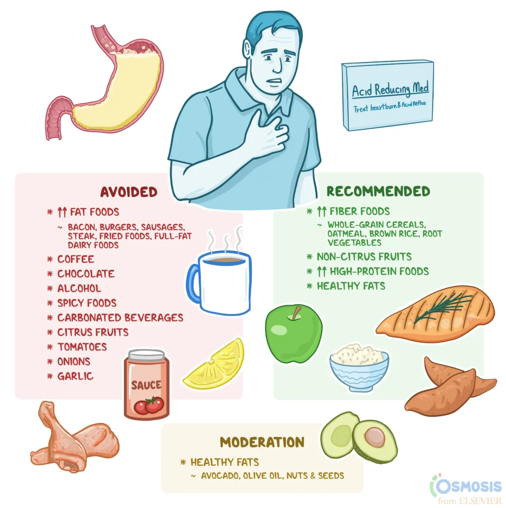 heartburn-causes