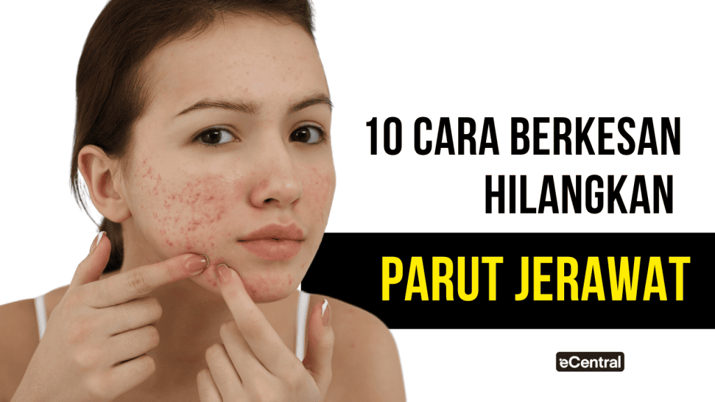 Cara Hilangkan Parut Jerawat Dalam Masa 1 Minggu