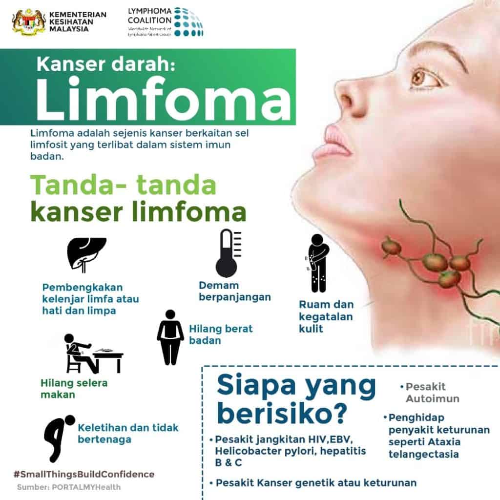 Kanser Limfoma