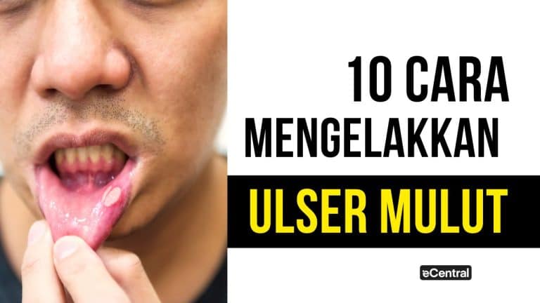 ulser mulut