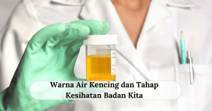 warna air kencing