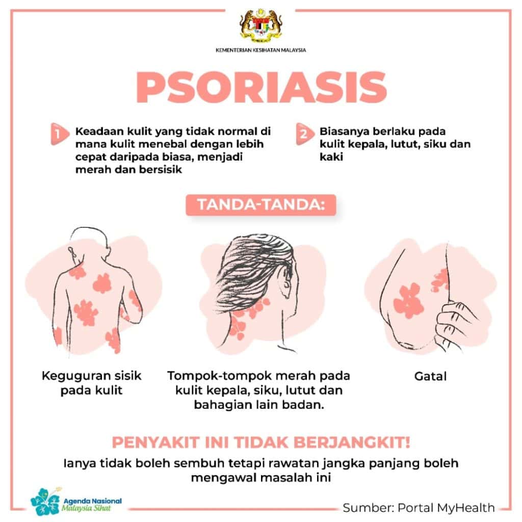 psoriasis