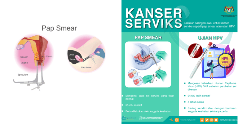 ujian pap smear