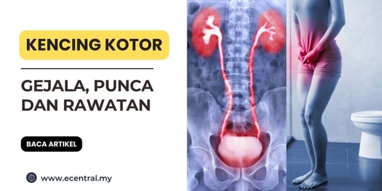 cara hilangkan kencing kotor dengan cepat