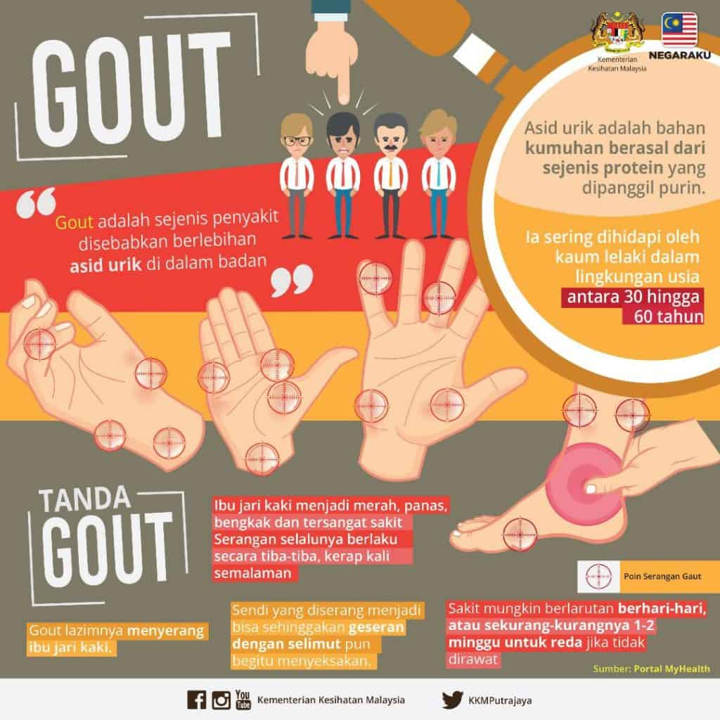 simptom gout