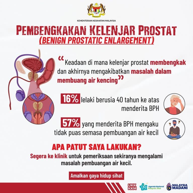 Pembengkakan kelenjar prostat