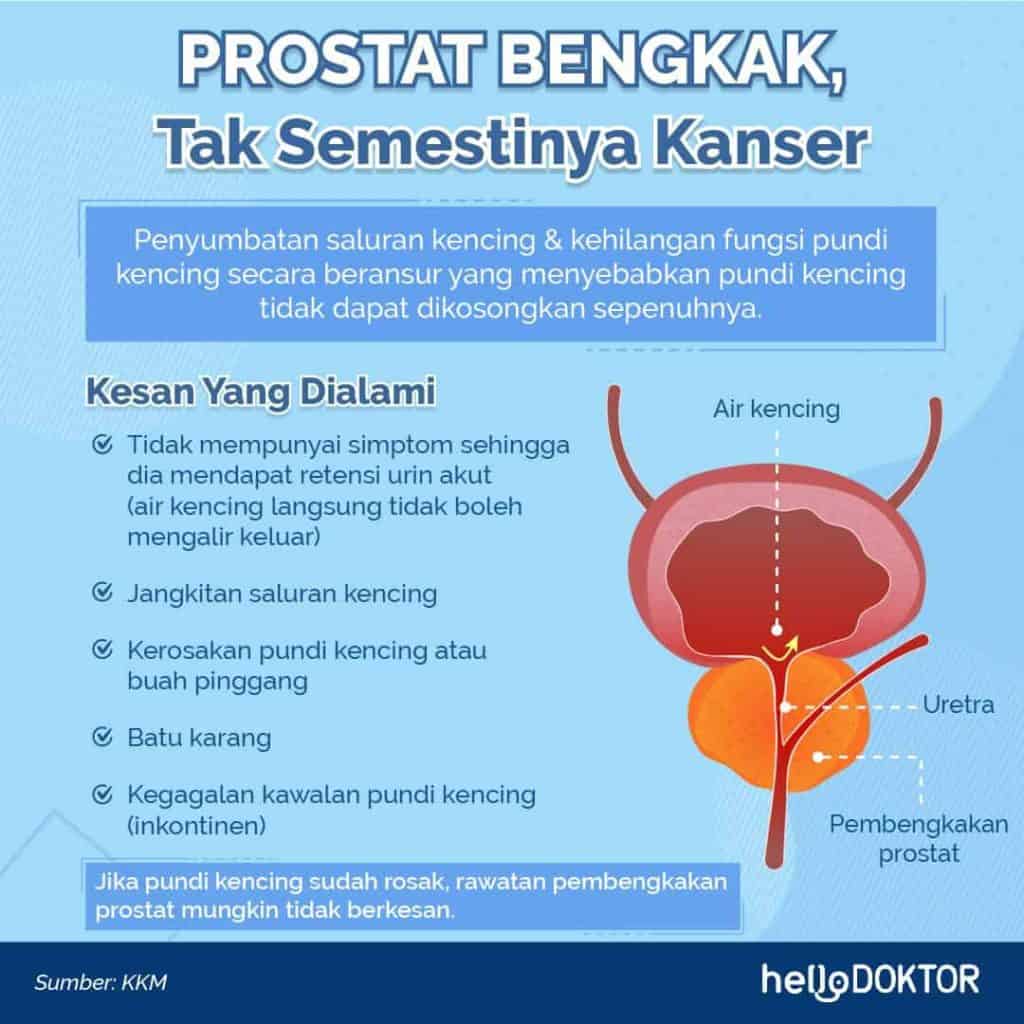 rawatan prostat bengkak