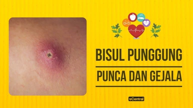 bisul di punggung
