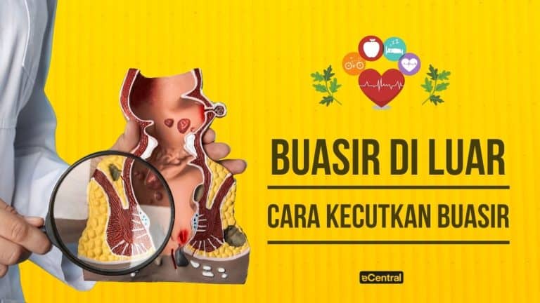cara nak kecutkan buasir luar