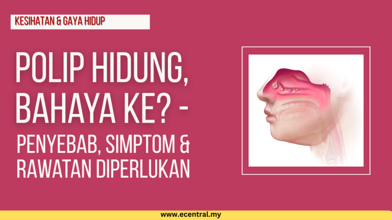 Polip Hidung, Bahaya ke? - Penyebab, Simptom & Rawatan