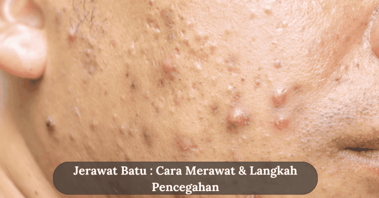 jerawat batu