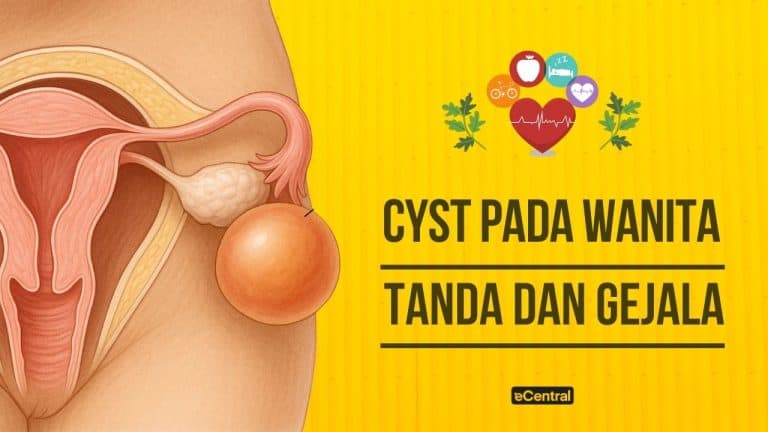 tanda cyst