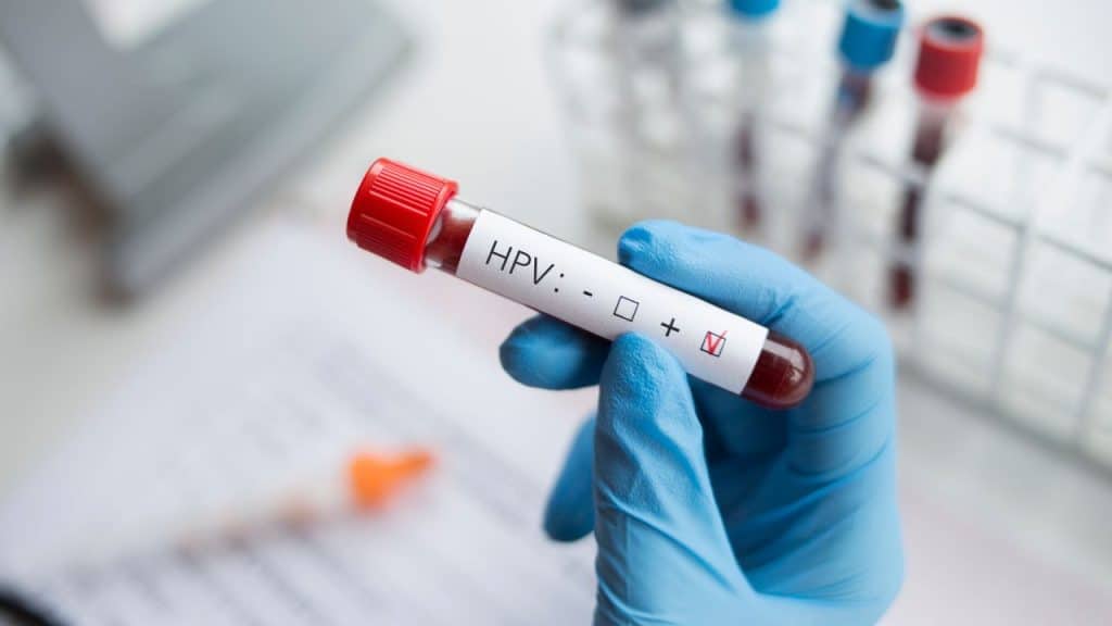 tanda hpv pada wanita