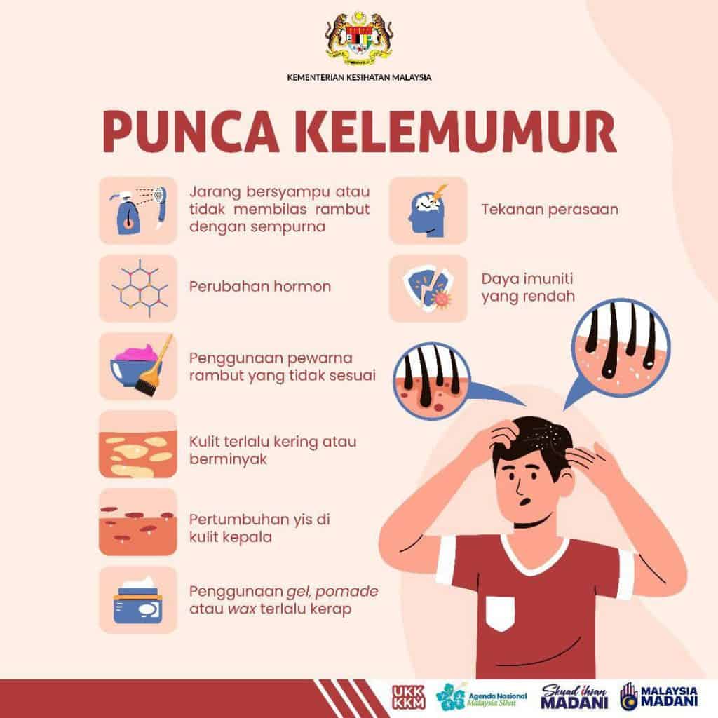 masalah kulit kepala