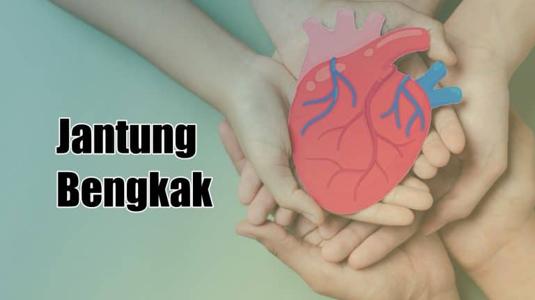 bengkak jantung