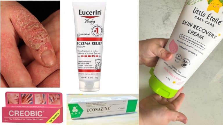 ubat gatal paling berkesan farmasi