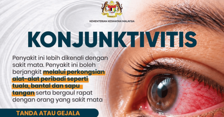 Konjunktivitis